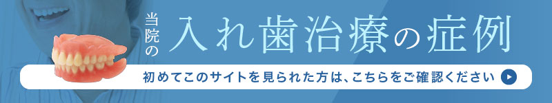 当院の入れ歯治療の症例:初めてこのサイトを見られた方は、こちらをご確認ください