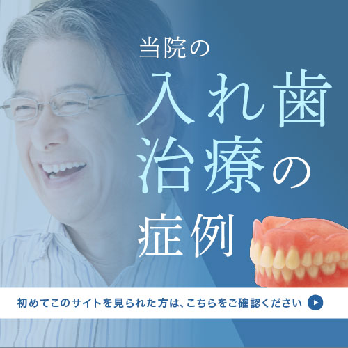 当院の入れ歯治療の症例:初めてこのサイトを見られた方は、こちらをご確認ください